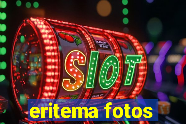 eritema fotos